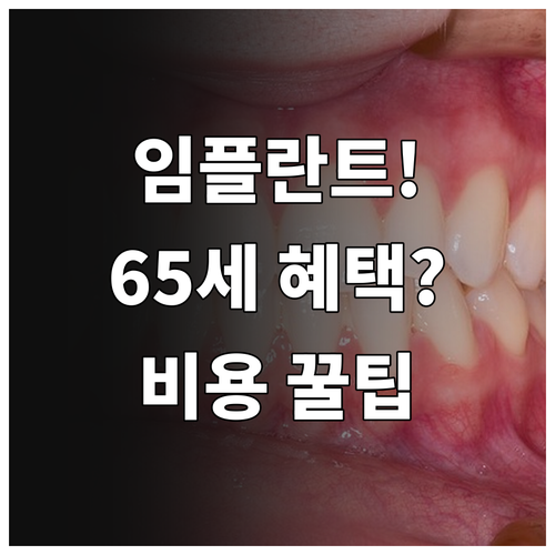 임플란트 보철물 교체 비용과 65세 이상 보험 혜택