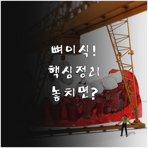 뼈 부족 시 임플란트 뼈이식 방법 총정리